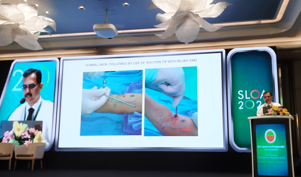 Dr viraj Shingade, Noted paediatric orthopaedic surgeon and Honarary Secretary of paediatric orthopaedic society of India